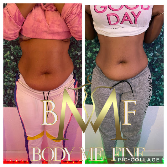 Body Contouring/ Sculpting Package