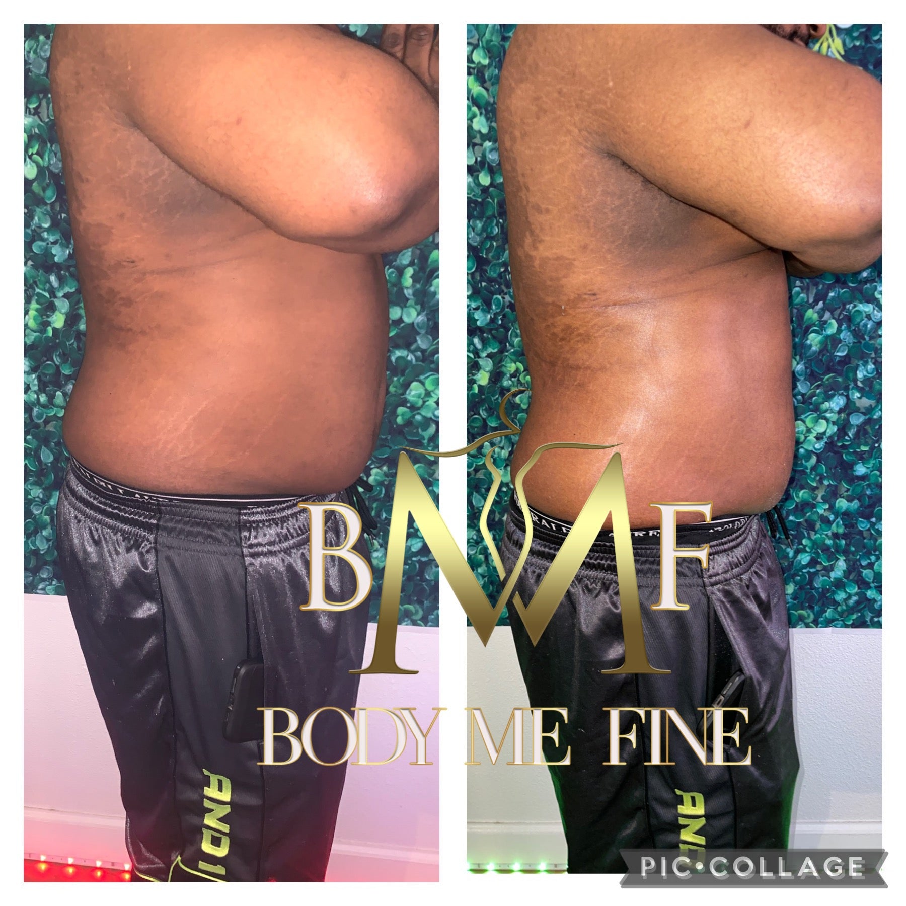 Body Contouring/ Sculpting Package – bodymefine