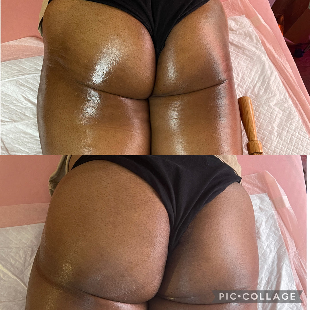 Natural BBL Package