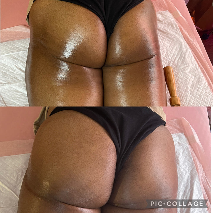 Natural BBL Package