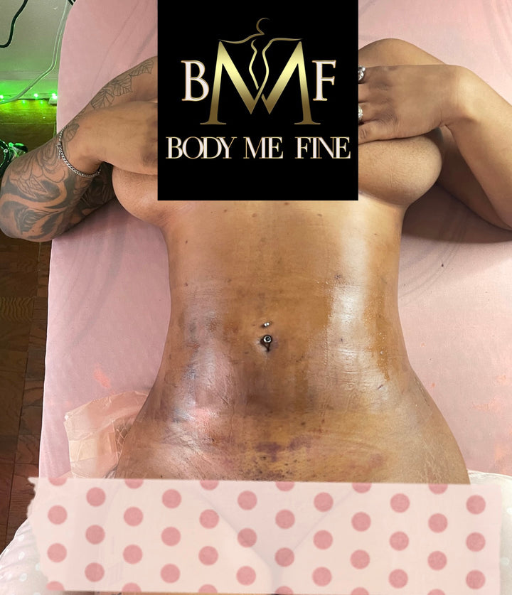 Post Op Package (Lymphatic Drainage Massage)